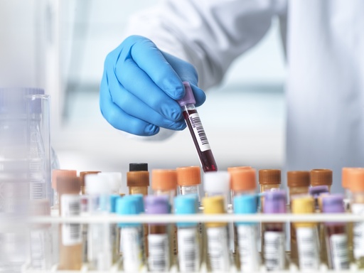 L’avenir du secteur de la biologie médicale
